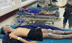 Bốn học sinh bỏng nặng khi chế pháo nổ Bốn học sinh bỏng nặng khi chế pháo nổ